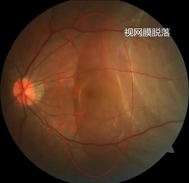 玩游戏手机膜该怎么选好_什么牌子的手机膜玩游戏好_玩手游什么手机膜比较好