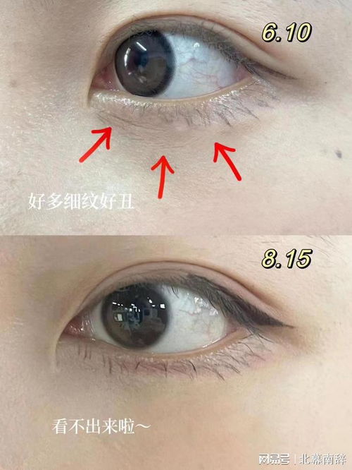 时光之帽 时光之帽